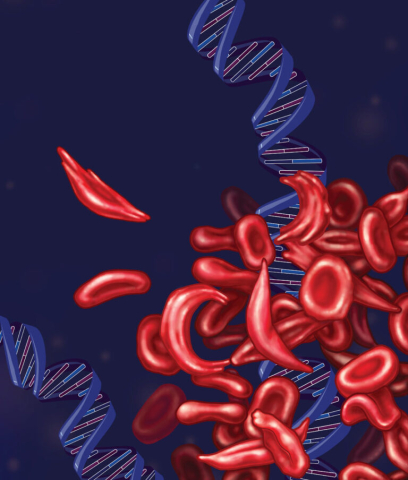 Illustration of sickle cell disease DNA